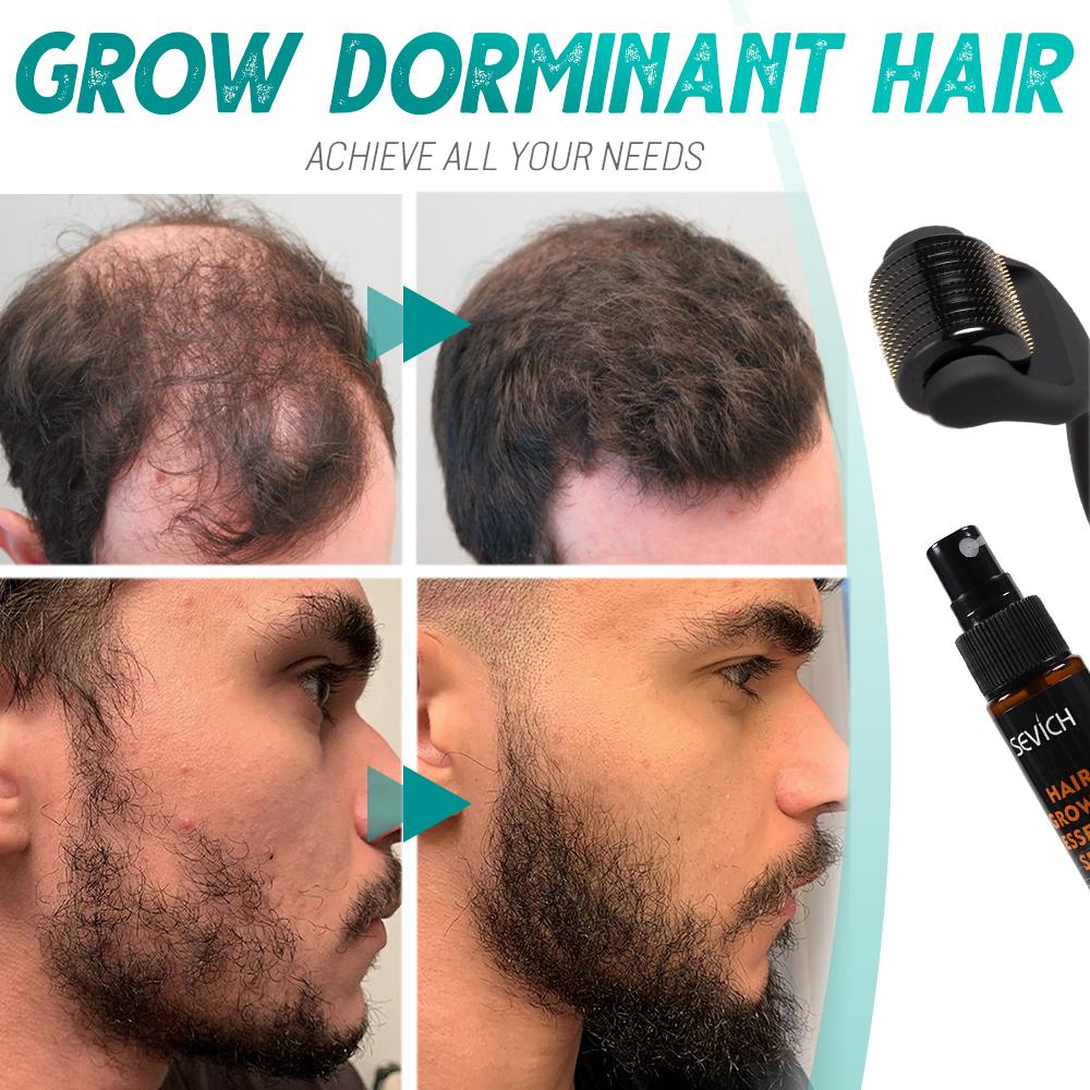 Beard Growth Roller Set